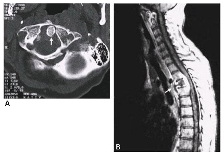 com.bmj.content.model.Caption@6104f580