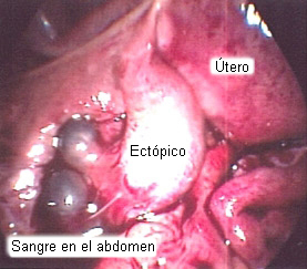 com.bmj.content.model.Caption@52677366