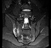 com.bmj.content.model.assessment.Caption@54f1bf3d