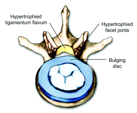 com.bmj.content.model.assessment.Caption@d88acde