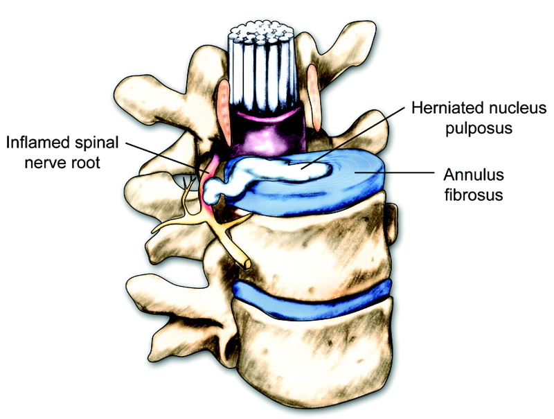 Assessment of back pain images