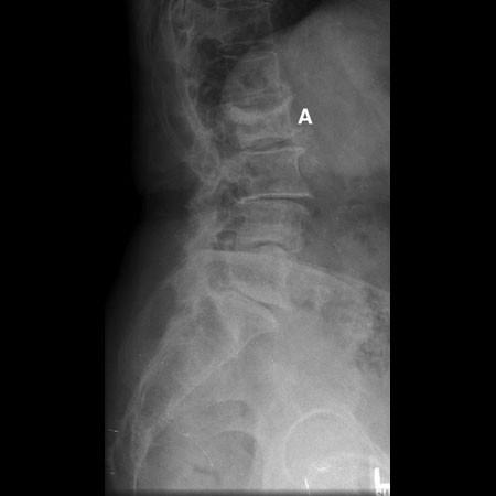 com.bmj.content.model.assessment.Caption@364ef75a