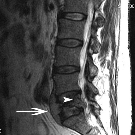 com.bmj.content.model.assessment.Caption@4bdc7866