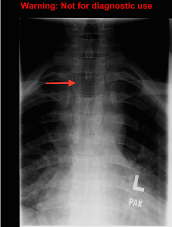 com.bmj.content.model.assessment.Caption@384a9e5a