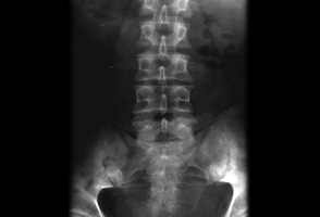 com.bmj.content.model.assessment.Caption@28c681cf