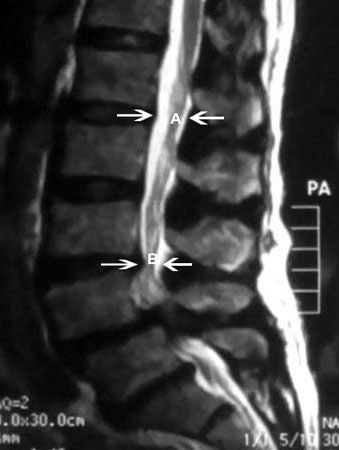 com.bmj.content.model.assessment.Caption@720888b2