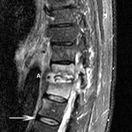 com.bmj.content.model.assessment.Caption@129125a2