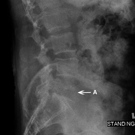 com.bmj.content.model.assessment.Caption@7cb8228