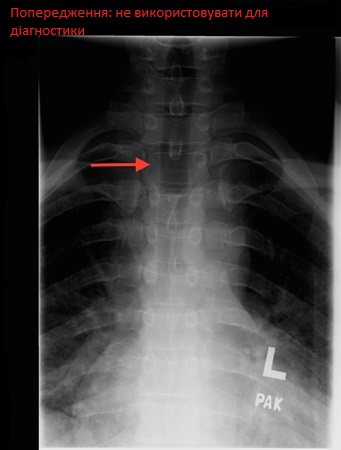 com.bmj.content.model.assessment.Caption@1c558ed2