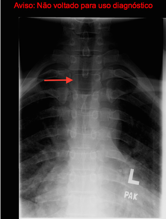 com.bmj.content.model.assessment.Caption@67228be3