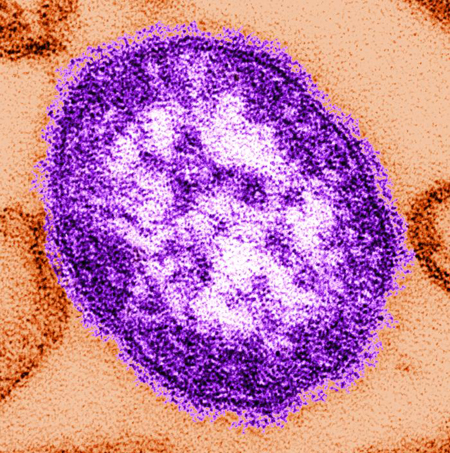 Measles infection images