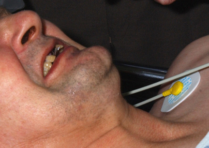 Tetanus images
