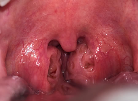 com.bmj.content.model.assessment.Caption@33e9a55a