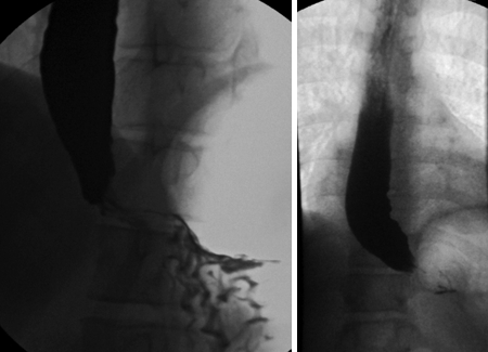 com.bmj.content.model.assessment.Caption@1a67c7da