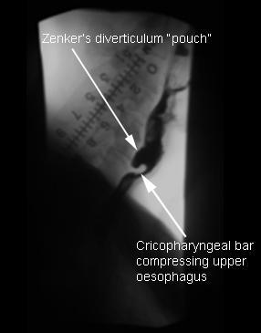 com.bmj.content.model.assessment.Caption@635de5d0