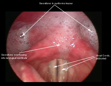 com.bmj.content.model.assessment.Caption@7eaa0cf0
