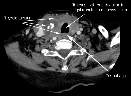 com.bmj.content.model.assessment.Caption@5a5cc4d3
