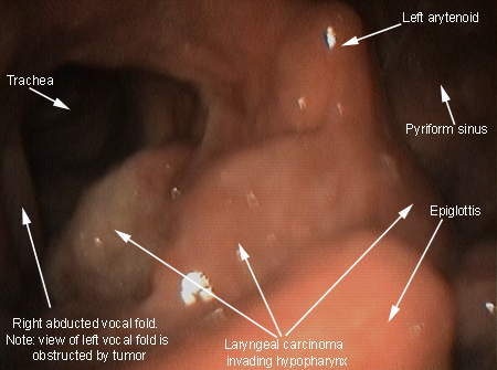 com.bmj.content.model.assessment.Caption@3595899d