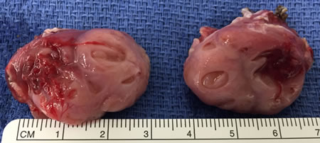 com.bmj.content.model.assessment.Caption@711c9844