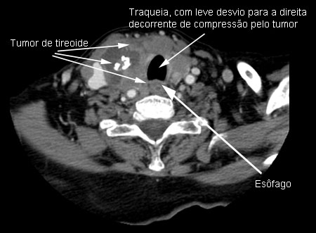 com.bmj.content.model.assessment.Caption@5773c91