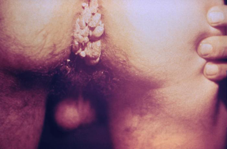 com.bmj.content.model.Caption@35f75662