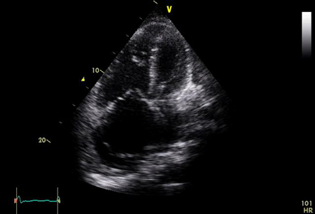 com.bmj.content.model.Caption@52e27922