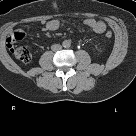 Assessment of dysuria images