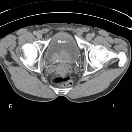 com.bmj.content.model.assessment.Caption@447264f4