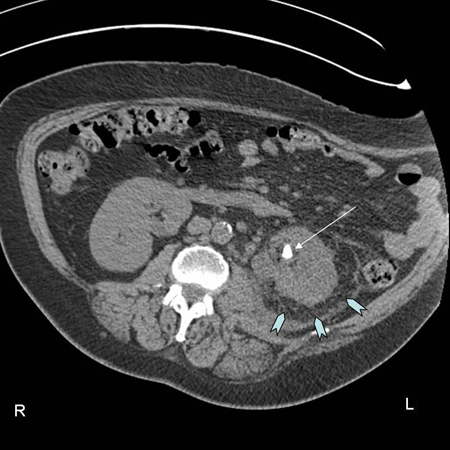 com.bmj.content.model.assessment.Caption@60c7678a