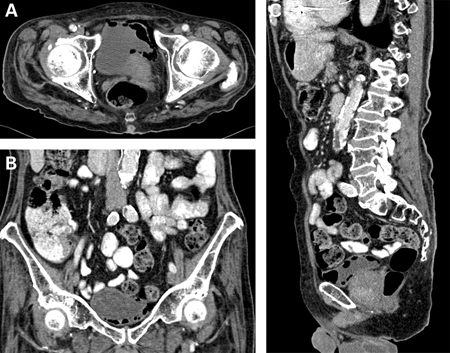 com.bmj.content.model.assessment.Caption@3519a296