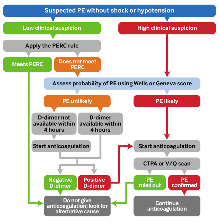 Summary: pulmonary embolism diagnostic pathway