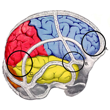 Mild traumatic brain injury images