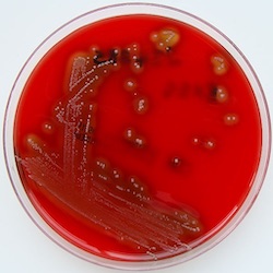 Streptococcus pyogenes (Lancefield group A) on Columbia horse blood agar