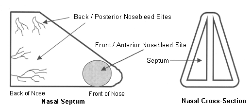 Diagram of bleeding sites in nose to accompany written patient information