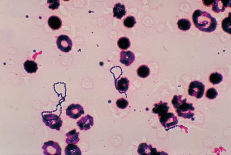 Photomicrograph of Streptococcus viridans bacteria that had been grown in a blood culture