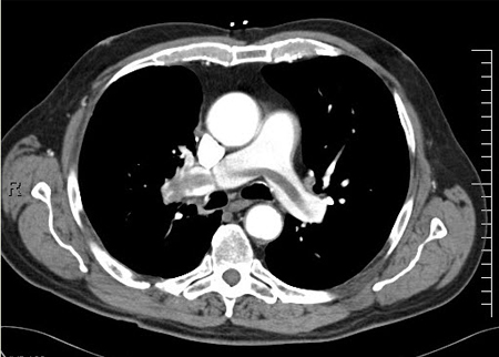 com.bmj.content.model.assessment.Caption@56913b88