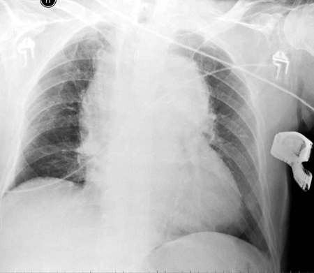 com.bmj.content.model.assessment.Caption@6445bb7a