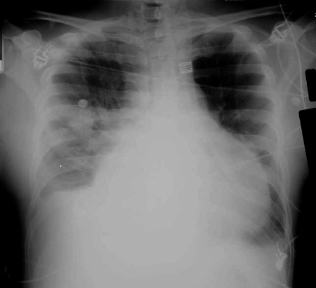 com.bmj.content.model.assessment.Caption@55b561e1