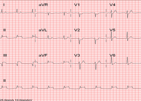 com.bmj.content.model.assessment.Caption@1fb5a220
