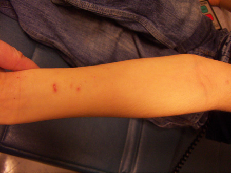 com.bmj.content.model.Caption@6a106371