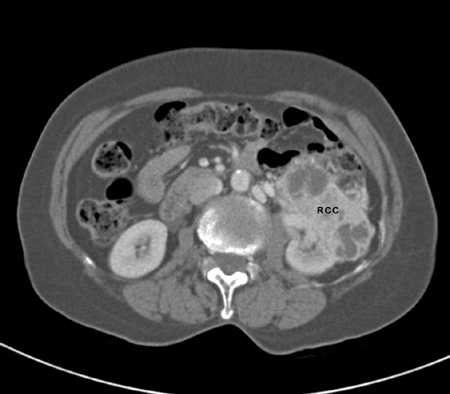 com.bmj.content.model.assessment.Caption@2f912443
