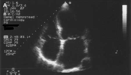 Assessment of cardiomyopathy images