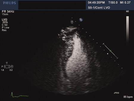 com.bmj.content.model.assessment.Caption@51d5d1a9