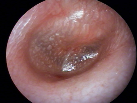 com.bmj.content.model.Caption@5bd0c624