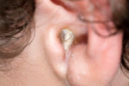 com.bmj.content.model.Caption@3403c600