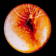 com.bmj.content.model.Caption@54c88e9c