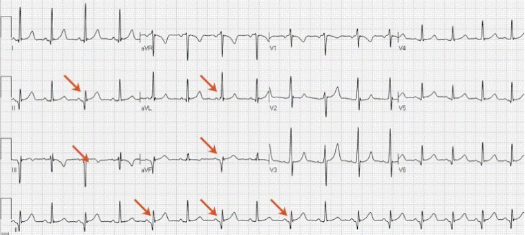 com.bmj.content.model.Caption@7b428730