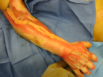 com.bmj.content.model.Caption@13a2a908