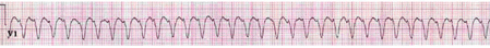 com.bmj.content.model.assessment.Caption@30314f42