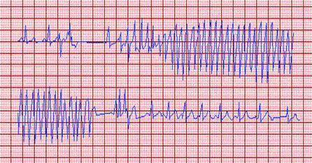 com.bmj.content.model.assessment.Caption@4d63859a